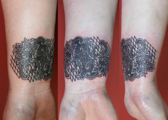 Lace work on wrist.jpg